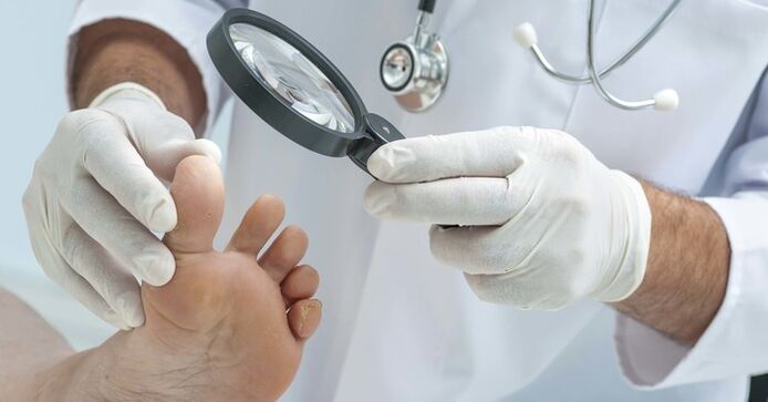 Diagnostic toenail exam. 