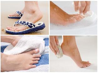the fungus of the skin of the feet of the prevention