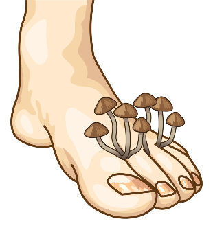 the signs of the fungus